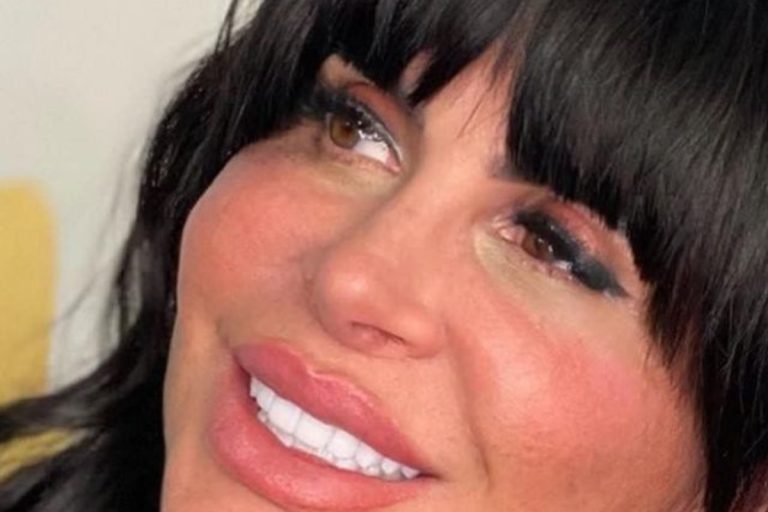 Harmonização ou "desarmonização"? Gretchen fica indignada com críticas: “Muito chato”