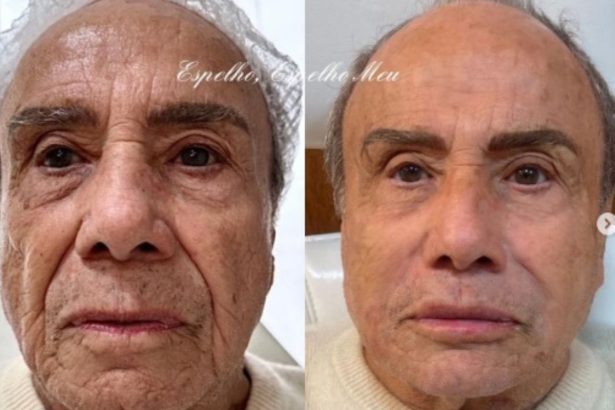 Stênio Garcia jovial; ator agita a web com transformação facial aos 91 anos; confira. Foto: Redes sociais