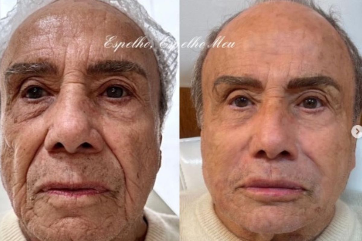 Stênio Garcia jovial; ator agita a web com transformação facial aos 91 anos; confira. Foto: Redes sociais