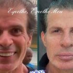 Túlio Maravilha faz harmonização facial e surpreende na internet; veja como ficou