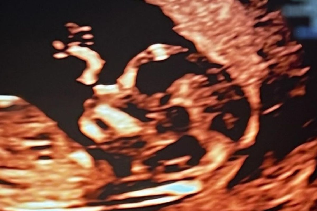 Fernanda Paes Leme e Victor Sampaio revelam primeira ‘selfie’ da bebê; confira