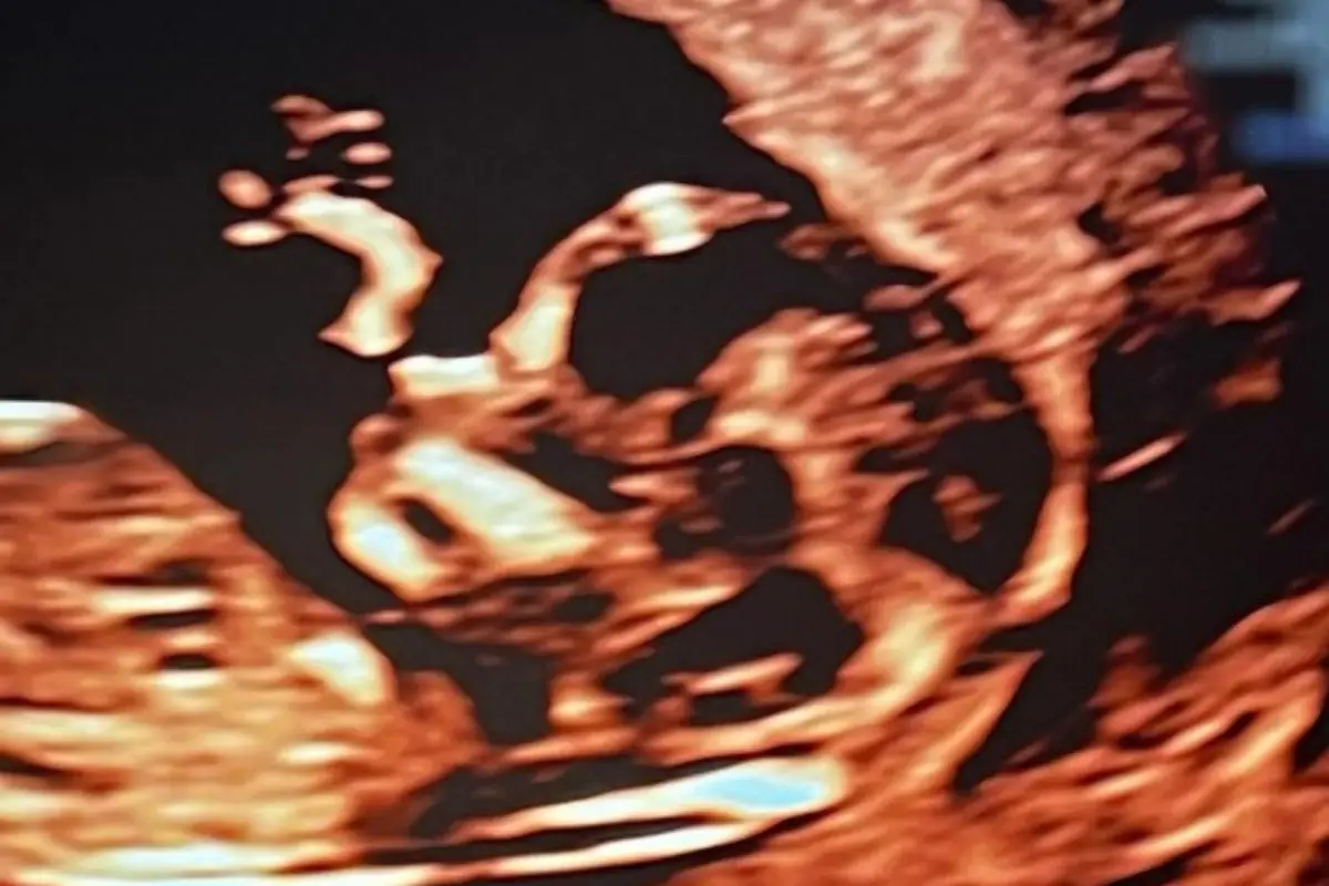 Fernanda Paes Leme e Victor Sampaio revelam primeira ‘selfie’ da bebê; confira Fernanda Paes Leme e Victor Sampaio revelam primeira ‘selfie’ da bebê; confira