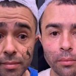 Diones Coelho ‘surfa’ na fama de Kayky Brito e ganha até harmonização facial; veja