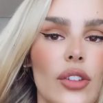 Yasmin Brunet confirma fratura em costela e revela como aconteceu; confira