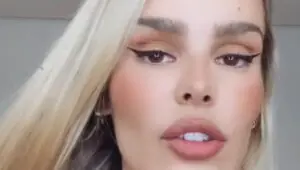Yasmin Brunet confirma fratura em costela e revela como aconteceu; confira
