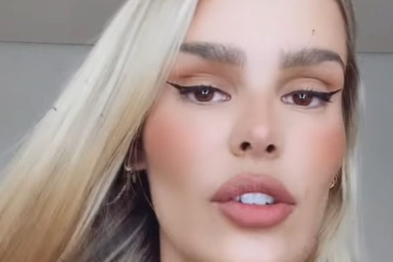 Yasmin Brunet confirma fratura em costela e revela como aconteceu; confira