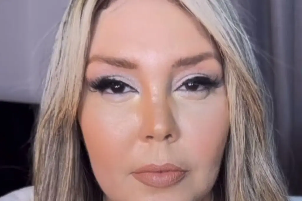 Simony reage a comentários e explica inchaço no rosto; veja. Foto: Instagram