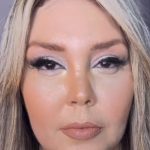 Simony reage a comentários e explica inchaço no rosto; veja. Foto: Instagram