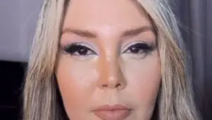 Simony reage a comentários e explica inchaço no rosto; veja. Foto: Instagram